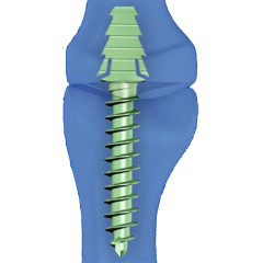 Flower Toe (Hammer Toe)