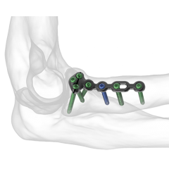 Protean Radial Head Plates