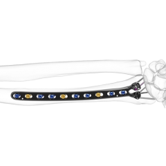 Geminus XL Distal Radius