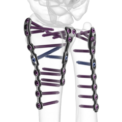 Protean Fragment Specific